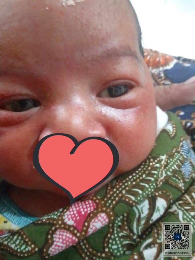 NTB Care Dibentuk Gubernur Zul, Tanpa APBD Telah Bantu Ribuan Orang Tidak Mampu