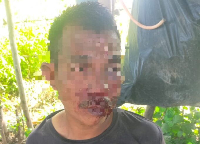 Diduga Gondol Gelang dengan Hipnotis, Tukang Tambal Ban Babak Belur