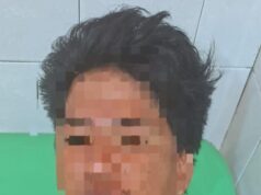 Polisi Buru Pelaku Penikaman di Plampang