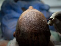Turki Bangun Kekuasaan Rambut dengan Teknologi dan Tradisi