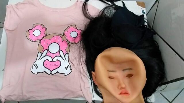 Wajah-Hancur-Akibat-Suntik-Silikon-Gelap