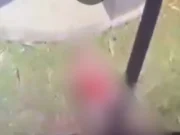 Bocah 6 Tahun Sembuh Usai Kesetrum Usai Dibully