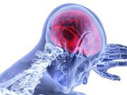 Terapi “Brain Freeze” Uji Coba Lindungi Otak Pasca-Stroke