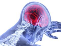 Terapi “Brain Freeze” Uji Coba Lindungi Otak Pasca-Stroke