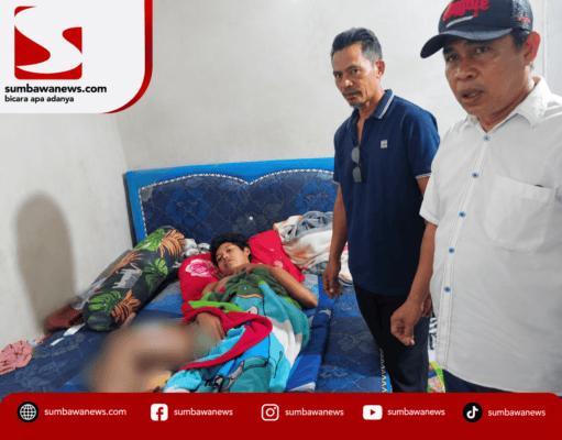 Bocah Asal Mantun Butuh Uluran Tangan, Keluarga Kesulitan Biayai Pengobatan Tumor Ganas