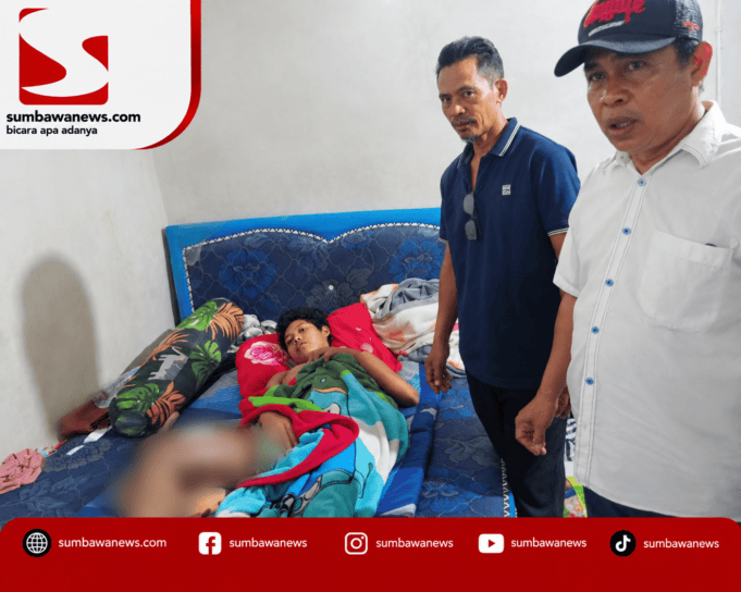 Bocah Asal Mantun Butuh Uluran Tangan, Keluarga Kesulitan Biayai Pengobatan Tumor Ganas
